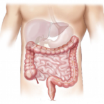 Morbo di Crohn : cause e conseguenze